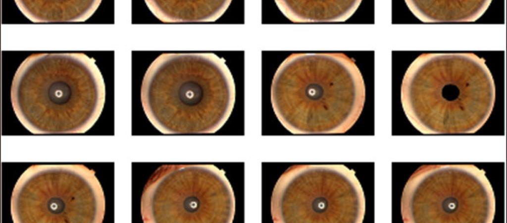 Biometric Authentication: IRIS image Capture, Storage and Processing