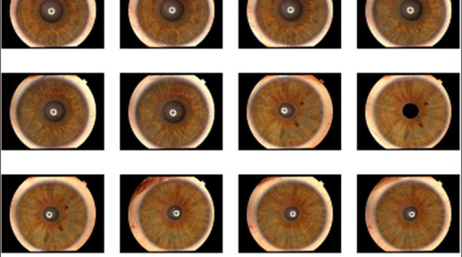 Biometric Authentication: IRIS image Capture, Storage and Processing